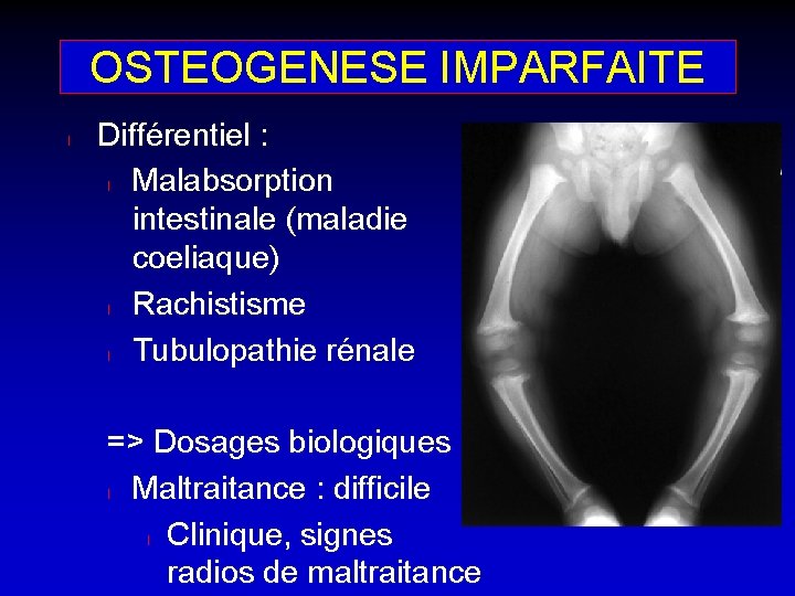 OSTEOGENESE IMPARFAITE l Différentiel : l Malabsorption intestinale (maladie coeliaque) l Rachistisme l Tubulopathie