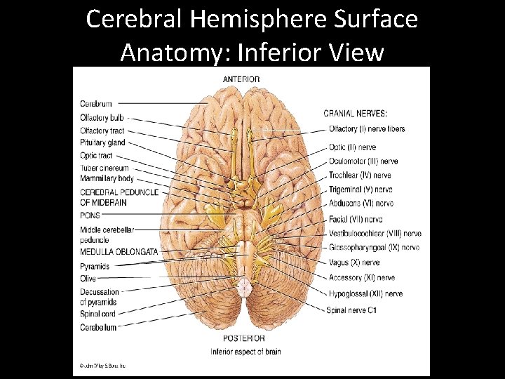 Cerebral Hemisphere Surface Anatomy: Inferior View 