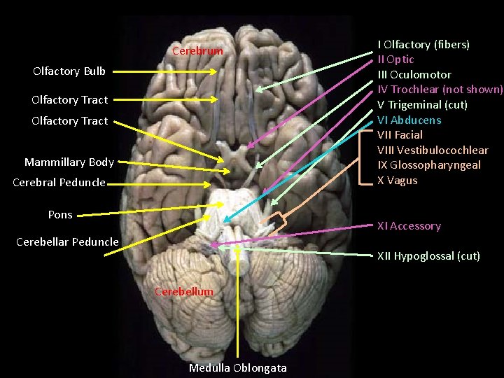 Cerebrum Olfactory Bulb Olfactory Tract Mammillary Body Cerebral Peduncle Pons I Olfactory (fibers) II