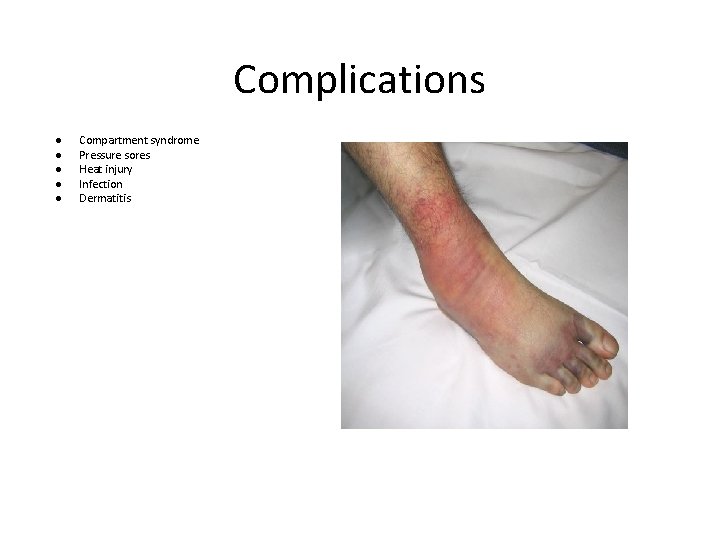 Complications ● ● ● Compartment syndrome Pressure sores Heat injury Infection Dermatitis 