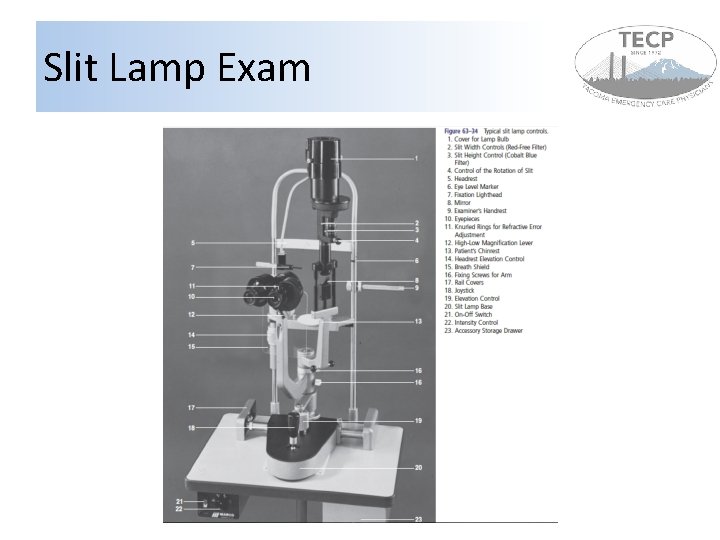 Slit Lamp Exam 