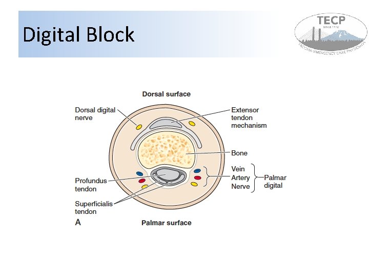 Digital Block 