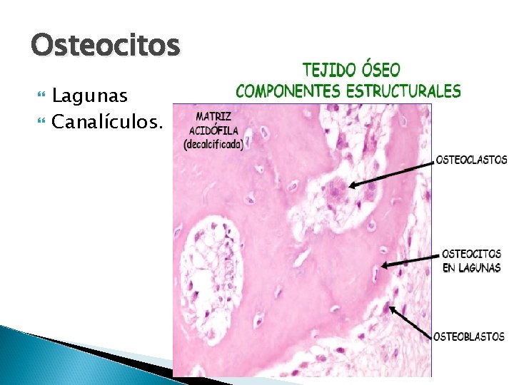Osteocitos Lagunas Canalículos. 