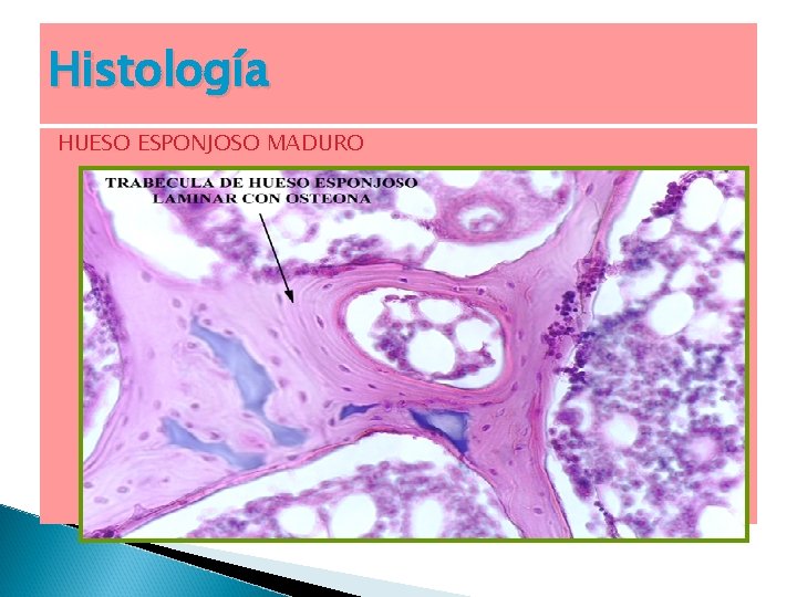 Histología HUESO ESPONJOSO MADURO 