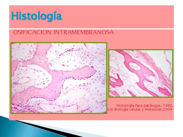 Histología OSIFICACION INTRAMEMBRANOSA Histología Para patólogos. 1992. Texto Atlas a color con Biología celular