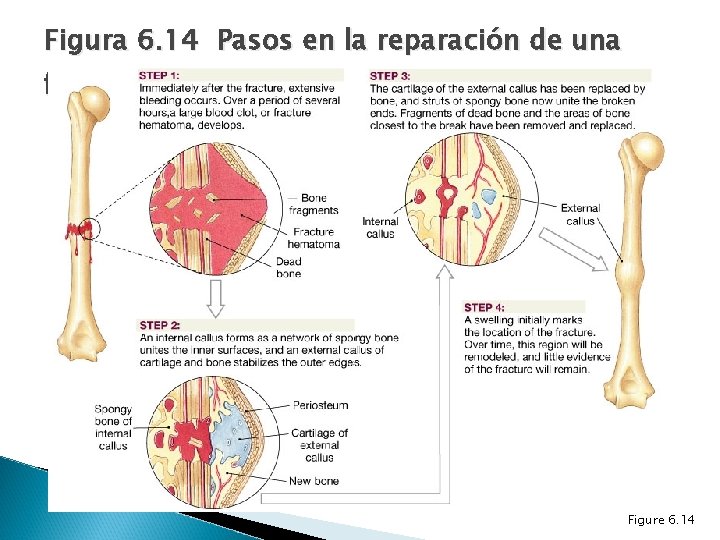Figura 6. 14 Pasos en la reparación de una fractura Figure 6. 14 