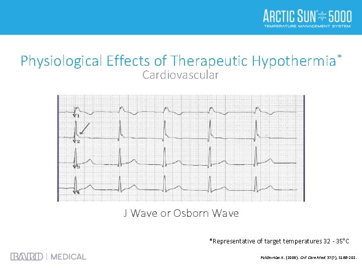 Physiological Effects of Therapeutic Hypothermia* Cardiovascular J Wave or Osborn Wave *Representative of target