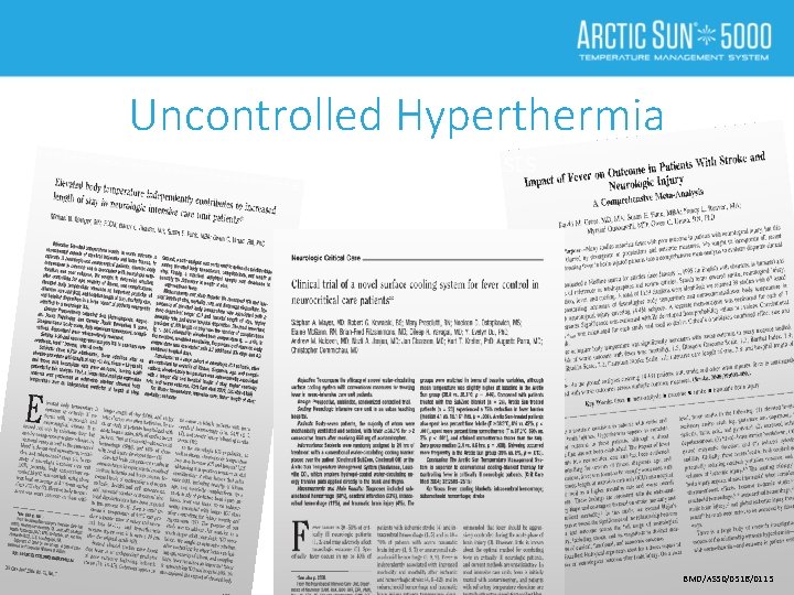 Uncontrolled Hyperthermia The Evidence Suggests Uncontrolled Hyperthermia Fever is Broken Blankets / Wraps /