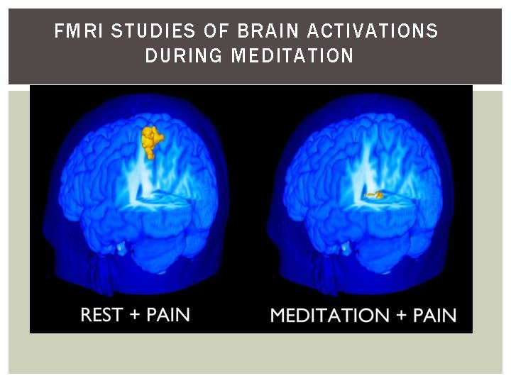 FMRI STUDIES OF BRAIN ACTIVATIONS DURING MEDITATION 