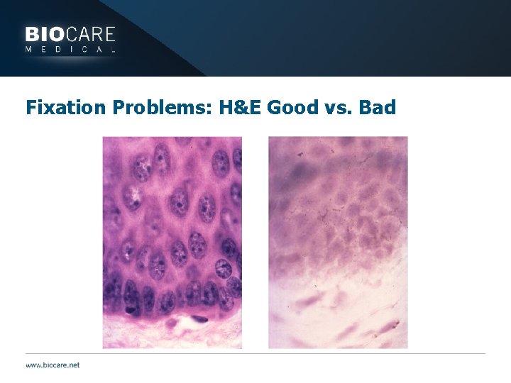 Fixation Problems: H&E Good vs. Bad 