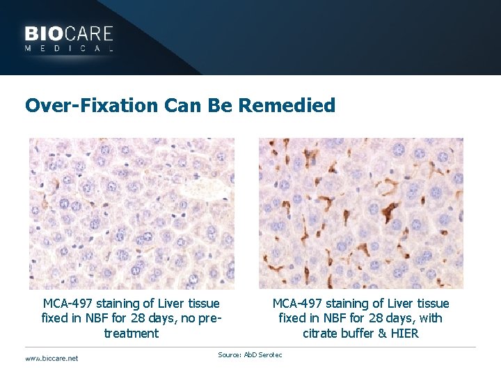 Over-Fixation Can Be Remedied MCA-497 staining of Liver tissue fixed in NBF for 28