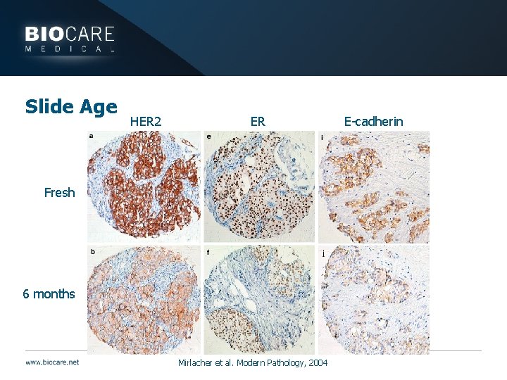 Slide Age HER 2 ER Fresh 6 months Mirlacher et al. Modern Pathology, 2004