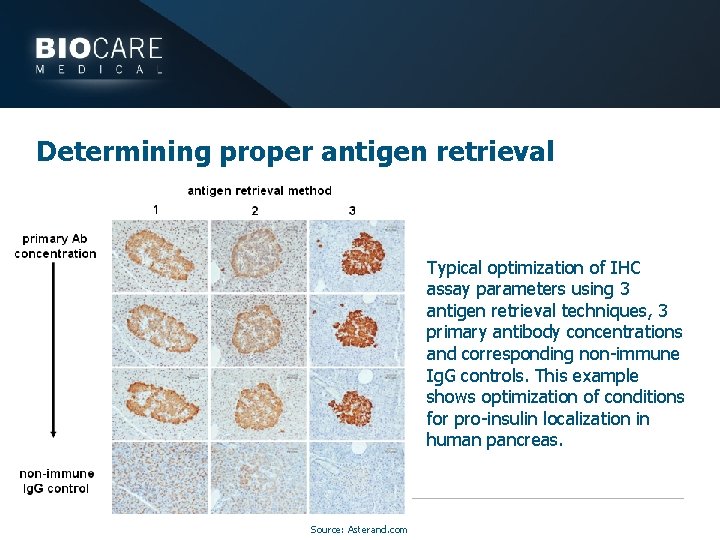 Determining proper antigen retrieval Typical optimization of IHC assay parameters using 3 antigen retrieval