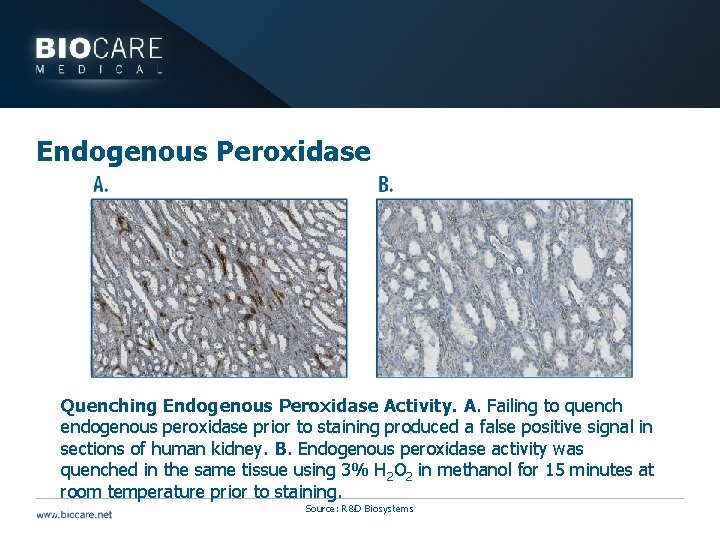 Endogenous Peroxidase Quenching Endogenous Peroxidase Activity. A. Failing to quench endogenous peroxidase prior to