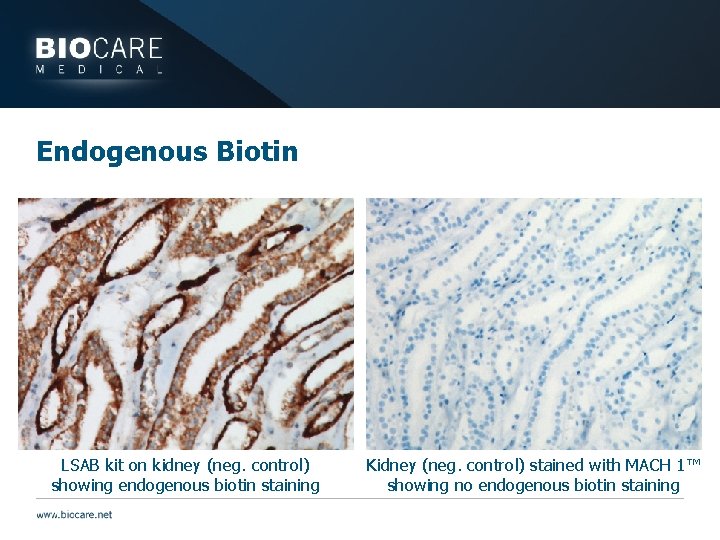 Endogenous Biotin LSAB kit on kidney (neg. control) showing endogenous biotin staining Kidney (neg.