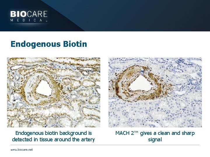 Endogenous Biotin Endogenous biotin background is detected in tissue around the artery MACH 2™