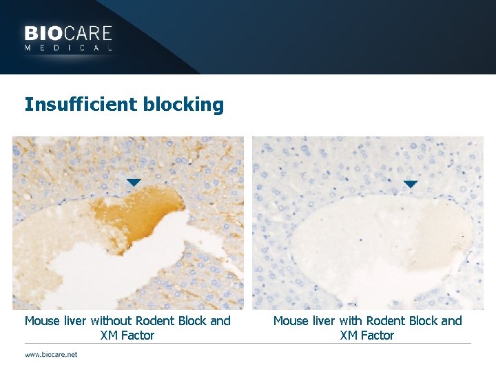 Insufficient blocking Mouse liver without Rodent Block and XM Factor Mouse liver with Rodent