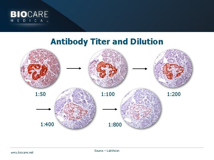 Antibody Titer and Dilution 1: 50 1: 400 1: 100 1: 800 Source –