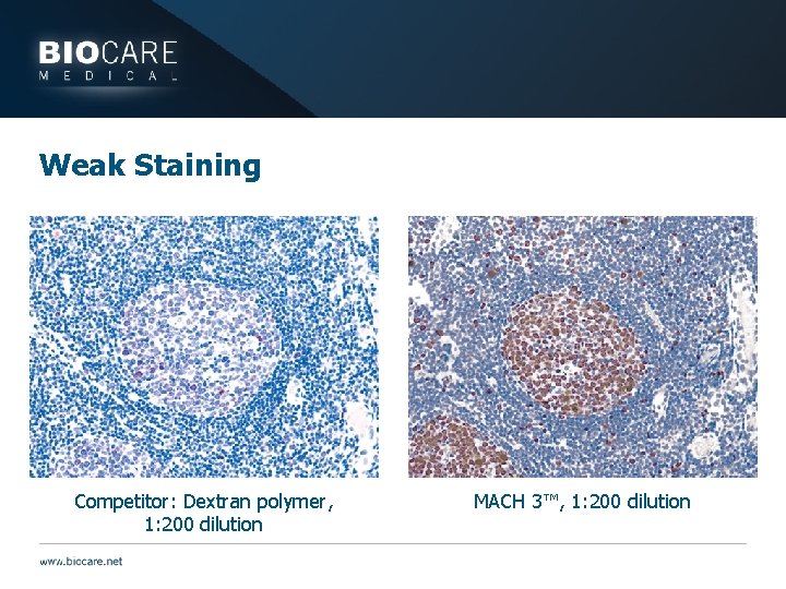 Weak Staining Competitor: Dextran polymer, 1: 200 dilution MACH 3™, 1: 200 dilution 