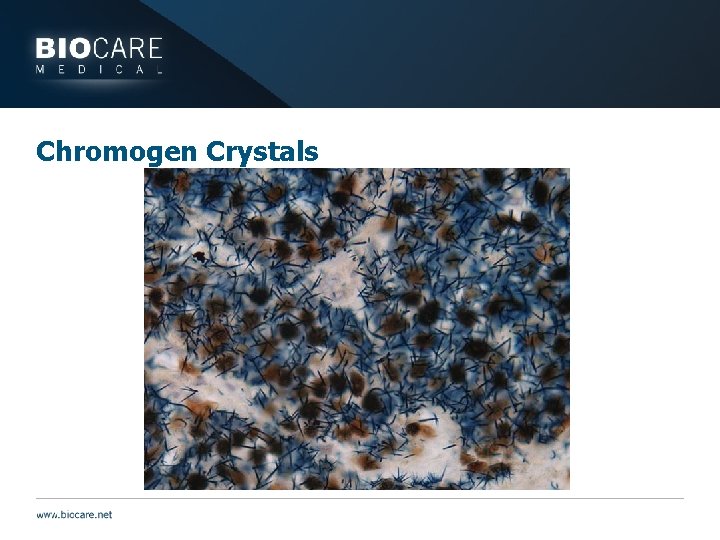 Chromogen Crystals 