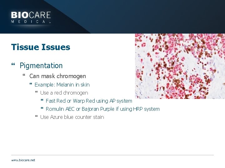 Tissue Issues } Pigmentation } Can mask chromogen } Example: Melanin in skin }