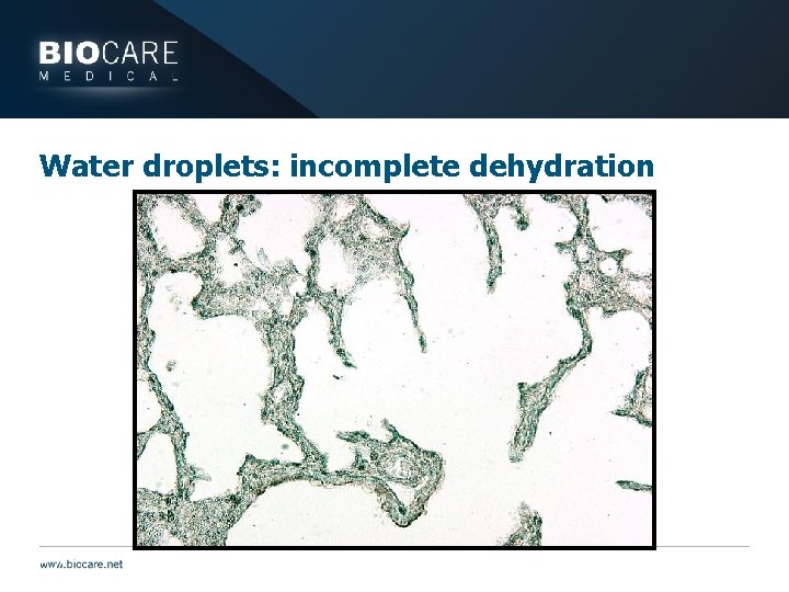 Water droplets: incomplete dehydration 