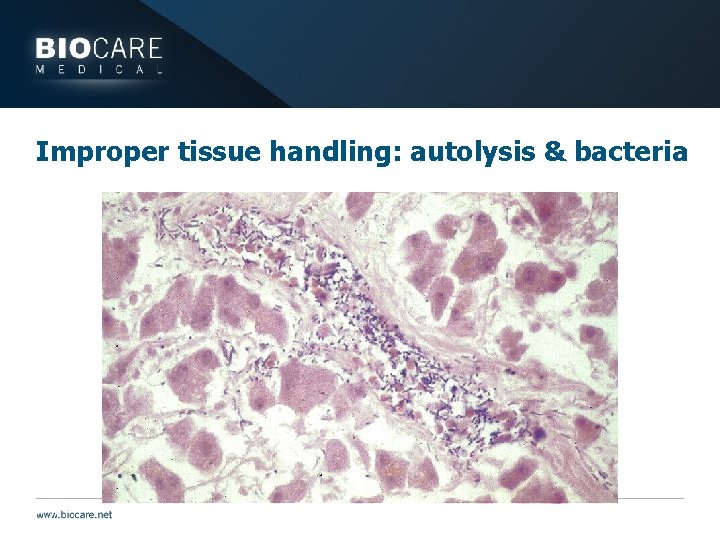 Improper tissue handling: autolysis & bacteria 