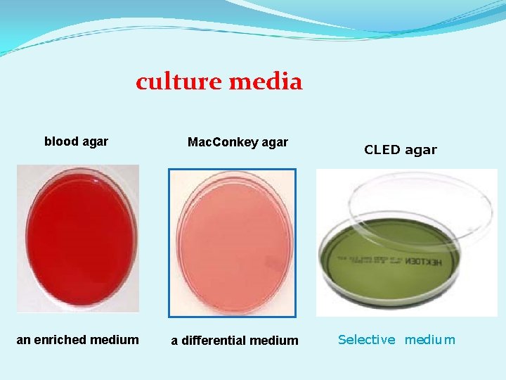 culture media blood agar Mac. Conkey agar an enriched medium a differential medium CLED