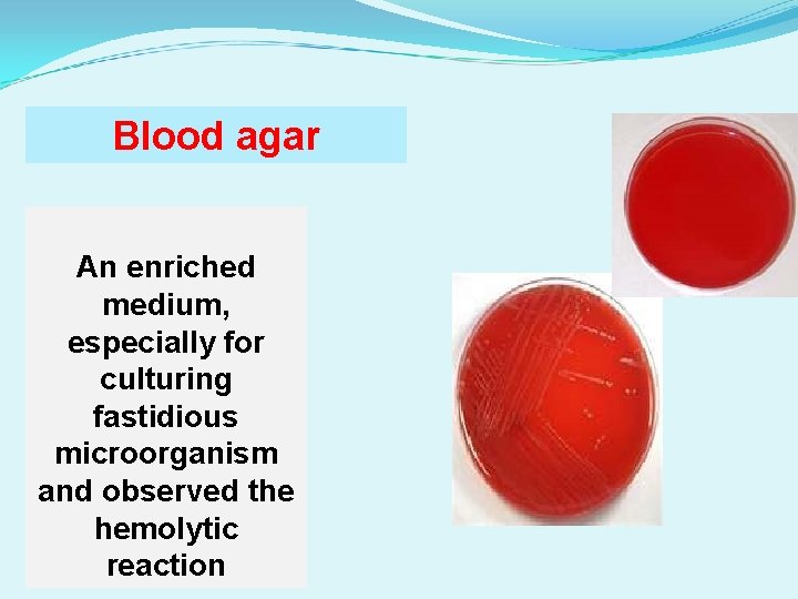 Blood agar An enriched medium, especially for culturing fastidious microorganism and observed the hemolytic Blood agar An enriched medium, especially for culturing fastidious microorganism and observed the hemolytic