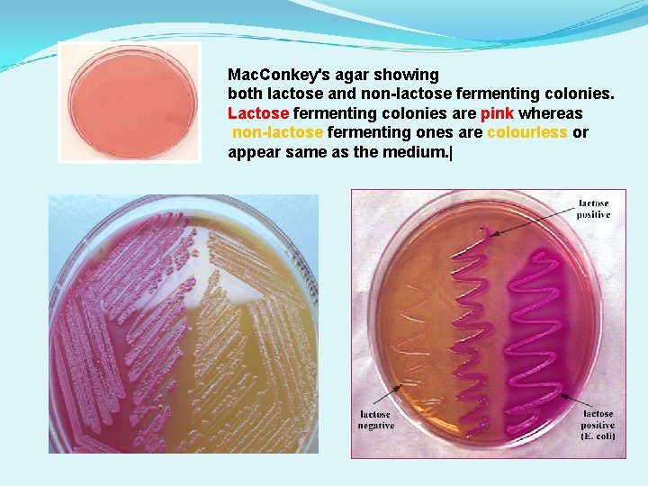 Mac. Conkey's agar showing both lactose and non-lactose fermenting colonies. Lactose fermenting colonies are Mac. Conkey's agar showing both lactose and non-lactose fermenting colonies. Lactose fermenting colonies are