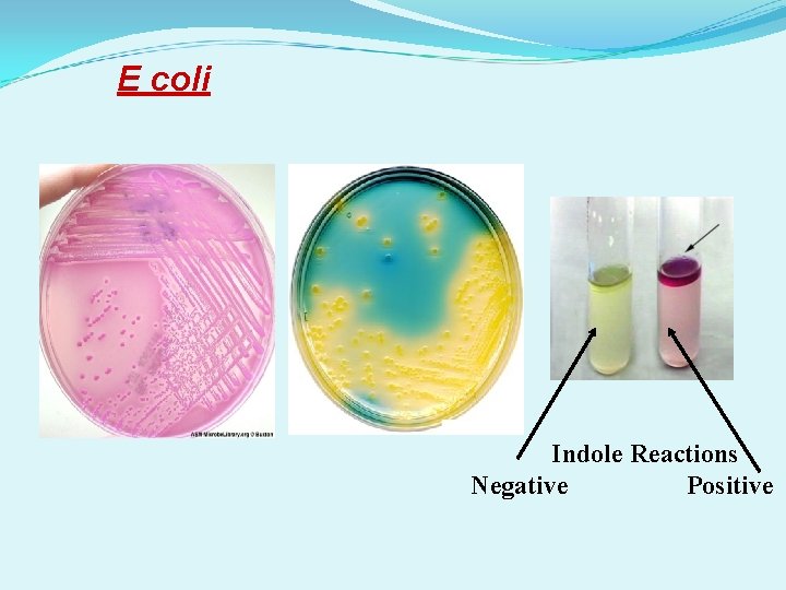 E coli Indole Reactions Negative Positive 