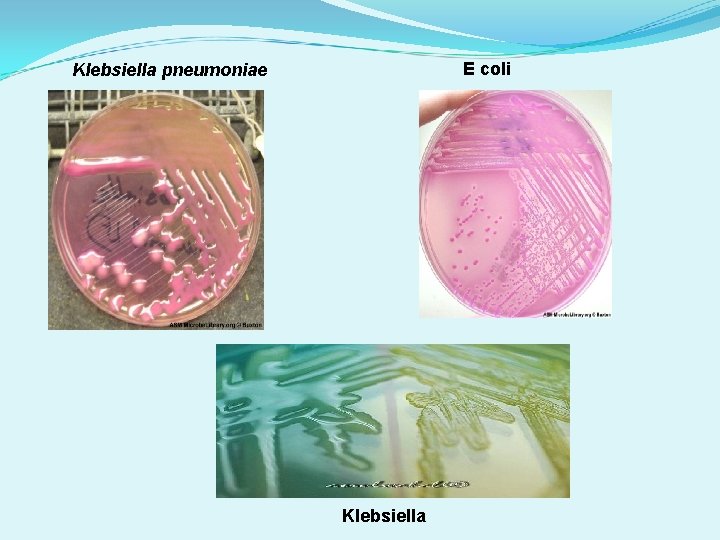 E coli Klebsiella pneumoniae Klebsiella E coli Klebsiella pneumoniae Klebsiella