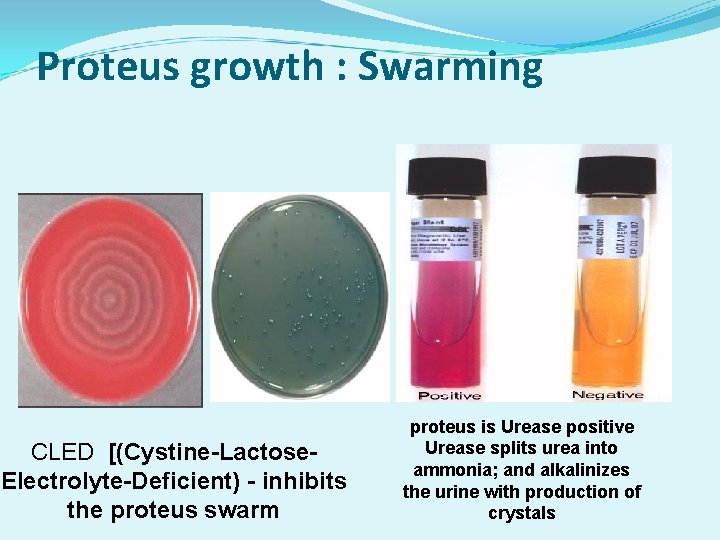 Proteus growth : Swarming CLED [(Cystine-Lactose. Electrolyte-Deficient) - inhibits the proteus swarm proteus is