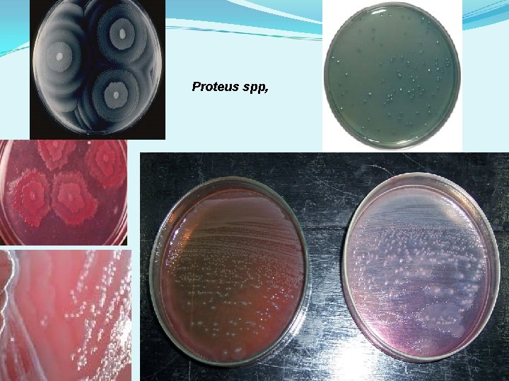 Proteus spp, Proteus spp,