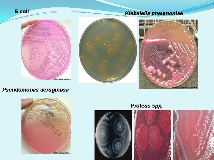 E coli Klebsiella pneumoniae Pseudomonas aeruginosa Proteus spp, 