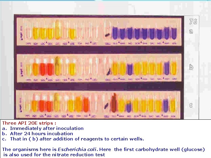 Three API 20 E strips : a. Immediately after inoculation b. After 24 hours