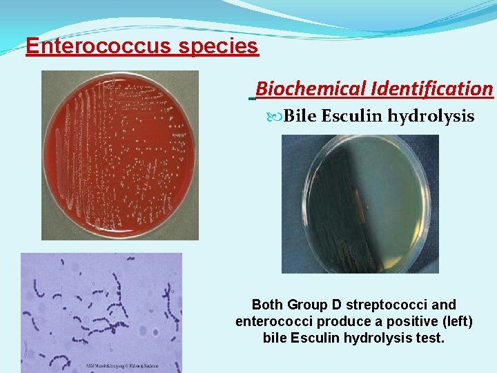 Enterococcus species Biochemical Identification Bile Esculin hydrolysis Both Group D streptococci and enterococci produce