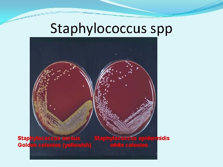 Staphylococcus spp Staphylococcus aureus Staphylococcus epidermidis Golden colonies (yellowish) white colonies Staphylococcus spp Staphylococcus aureus Staphylococcus epidermidis Golden colonies (yellowish) white colonies