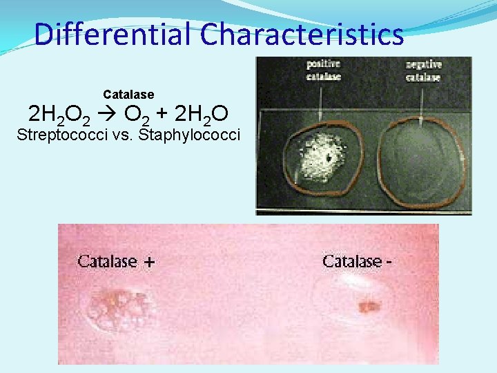 Differential Characteristics Catalase 2 H 2 O 2 + 2 H 2 O Streptococci Differential Characteristics Catalase 2 H 2 O 2 + 2 H 2 O Streptococci