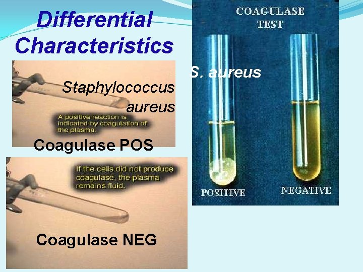 Differential Characteristics Staphylococcus aureus Coagulase POS Coagulase NEG S. aureus 