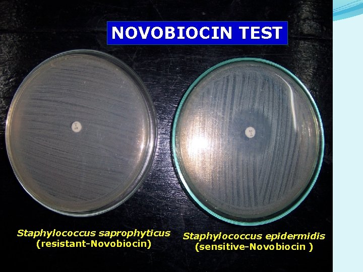 NOVOBIOCIN TEST Staphylococcus saprophyticus (resistant-Novobiocin) Staphylococcus epidermidis (sensitive-Novobiocin ) NOVOBIOCIN TEST Staphylococcus saprophyticus (resistant-Novobiocin) Staphylococcus epidermidis (sensitive-Novobiocin )