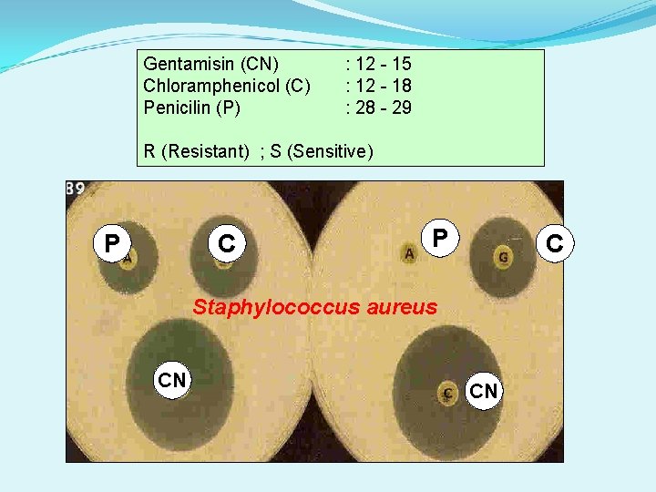 Gentamisin (CN) Chloramphenicol (C) Penicilin (P) : 12 - 15 : 12 - 18
