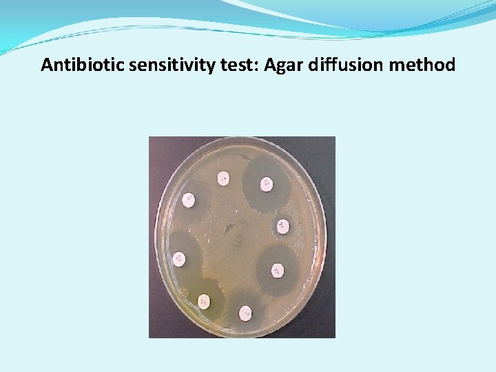 Antibiotic sensitivity test: Agar diffusion method Antibiotic sensitivity test: Agar diffusion method