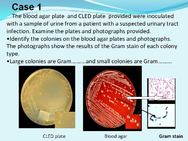 Case 1 The blood agar plate and CLED plate provided were inoculated with a