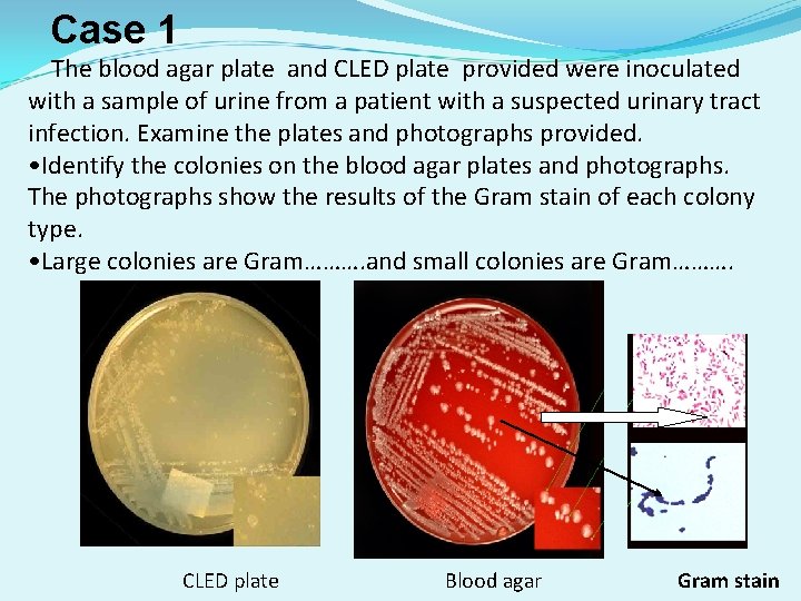 Case 1 The blood agar plate and CLED plate provided were inoculated with a Case 1 The blood agar plate and CLED plate provided were inoculated with a