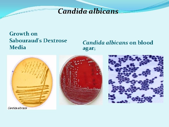 Candida albicans Growth on Sabouraud's Dextrose Media Candida albicans on blood agar; Candida albicans Growth on Sabouraud's Dextrose Media Candida albicans on blood agar;