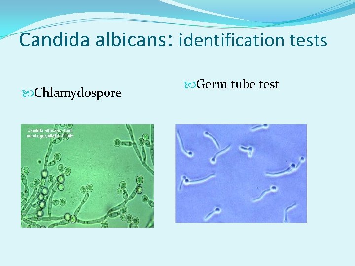 Candida albicans: identification tests Chlamydospore Germ tube test 