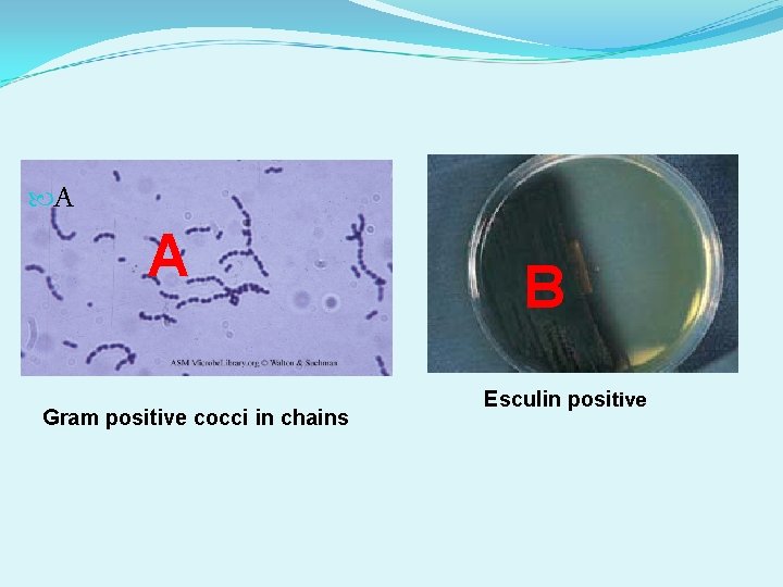 A A Gram positive cocci in chains B Esculin positive A A Gram positive cocci in chains B Esculin positive