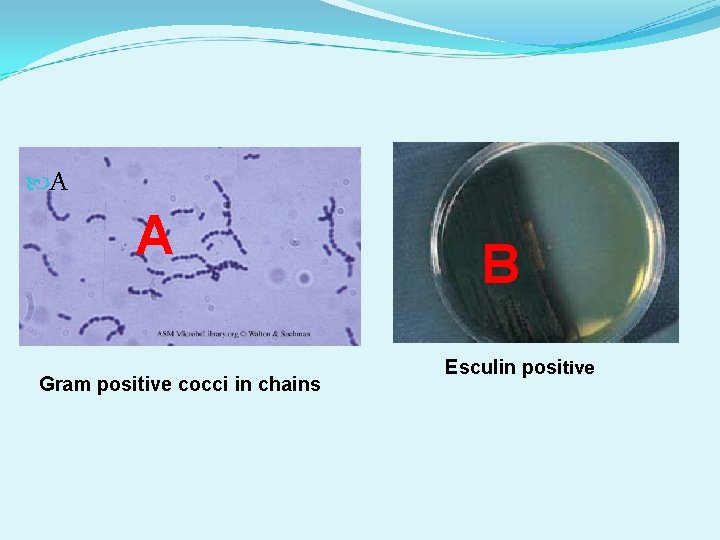  A A Gram positive cocci in chains B Esculin positive 