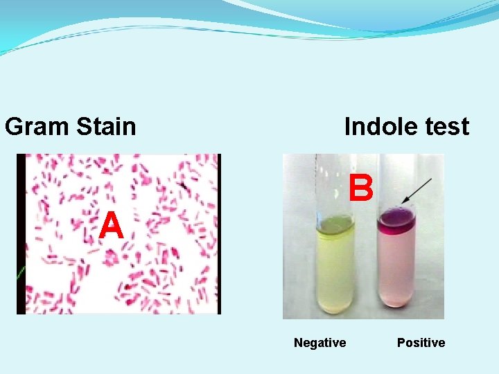 Gram Stain Indole test B A Negative Positive 